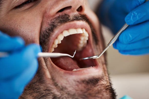 Best Pediatric Emergency Dentist in Roswell, NM